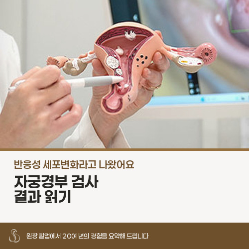 자궁경부 세포검사 결과 '반응성세포변화', 바로 치료가 필요한가요?